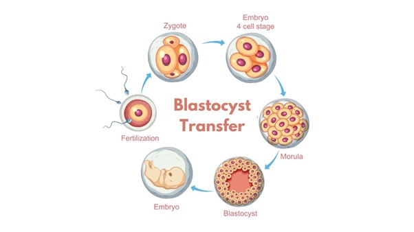 IVF specialist in Pune