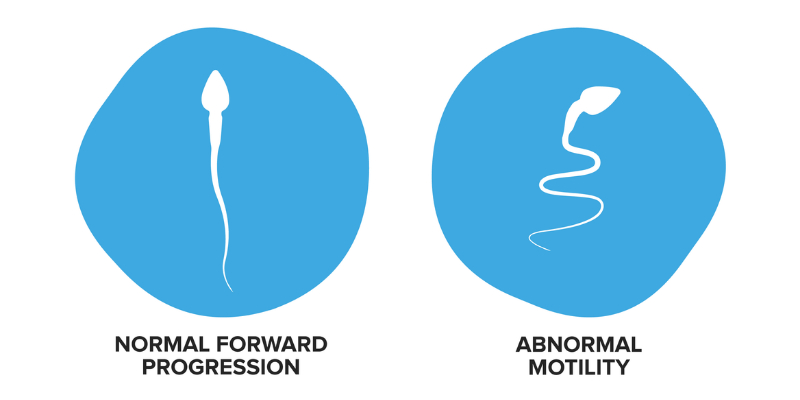 Low Sperm Motility