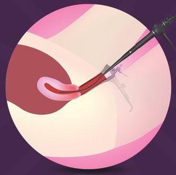 best ivf center in pune