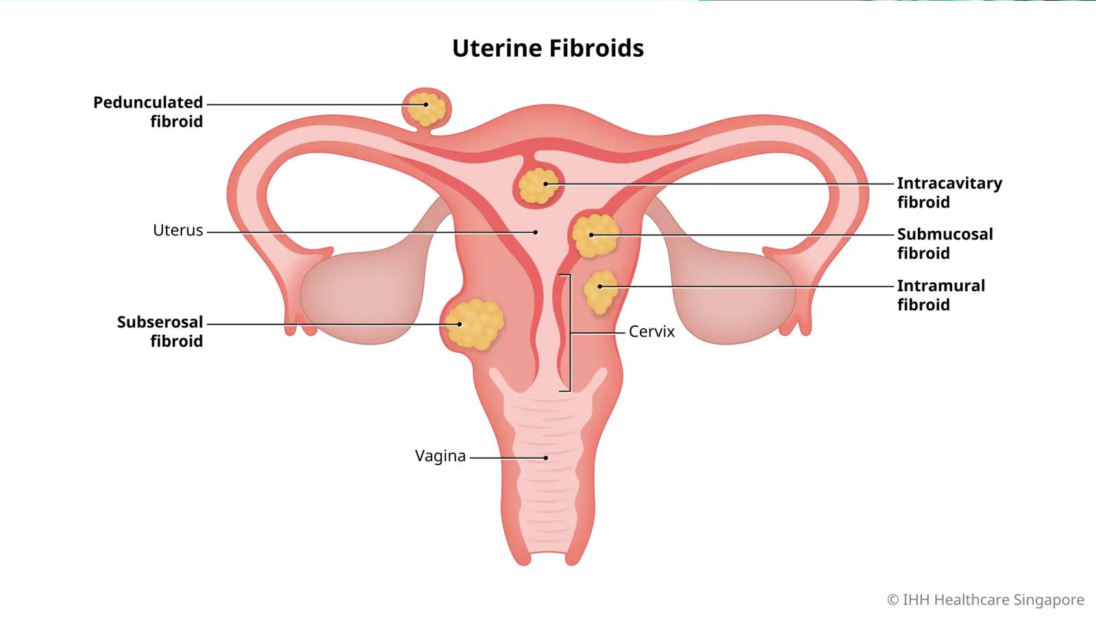 IVF specialist in Pune