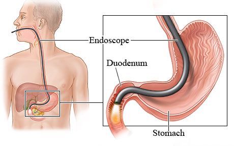 Endoscopy Doctor in Pune