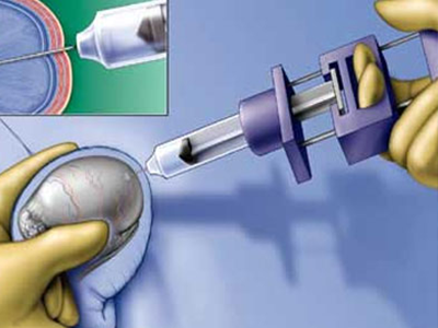 IVF specialist in Pune
