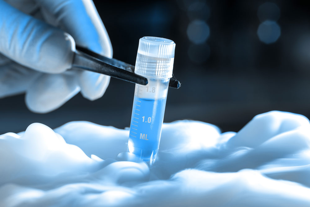 IVF specialist in Pune