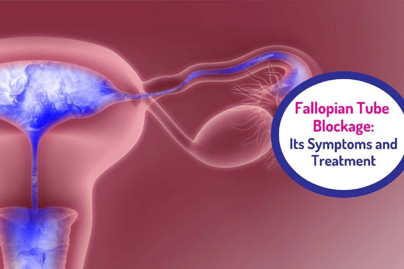 IVF specialist in Pune