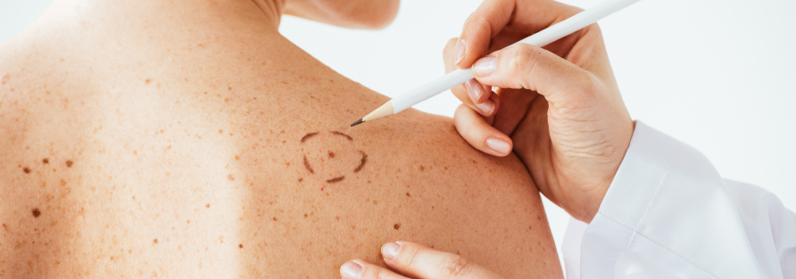 Dermatology