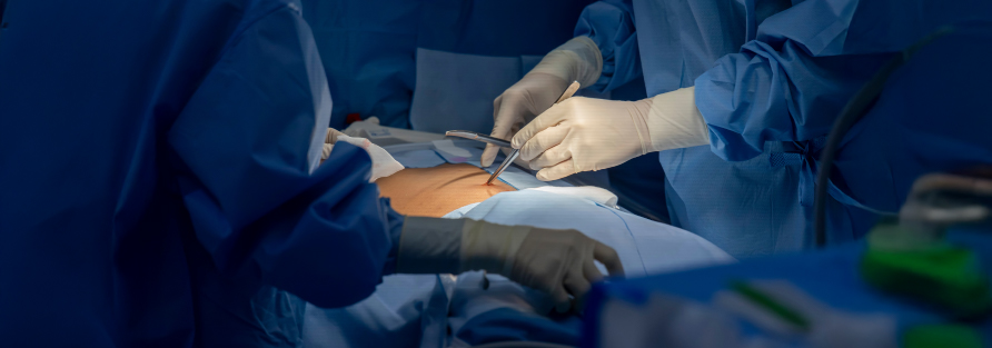 General Surgery Operation